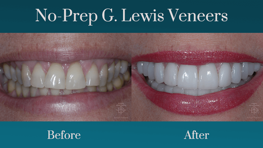 cosmetic dentistry procedures